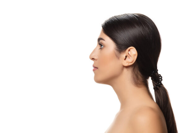 Αναίμακτη Ρινοπλαστική