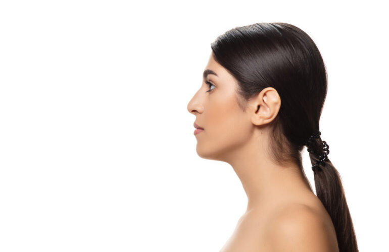 Αναίμακτη Ρινοπλαστική