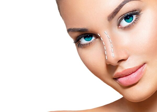 ΔιαφραγματοΡινοπλαστική