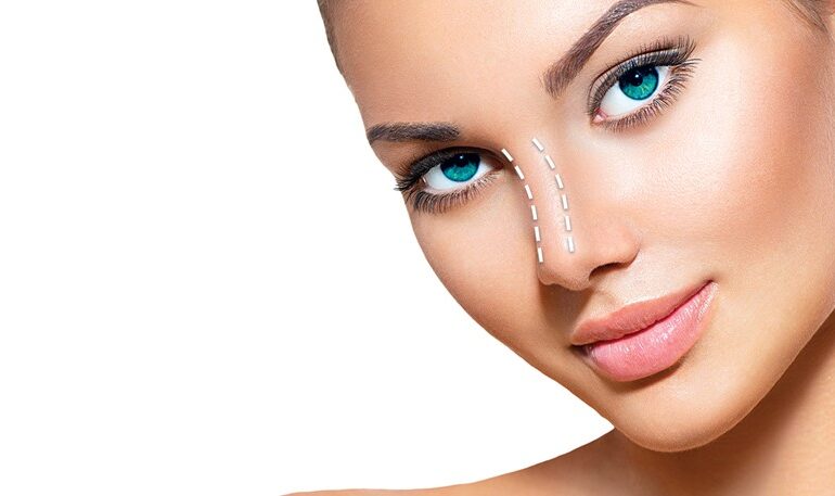 ΔιαφραγματοΡινοπλαστική