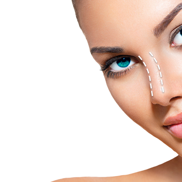 Βελτίωση της εξωτερικής εμφάνισης της μύτης